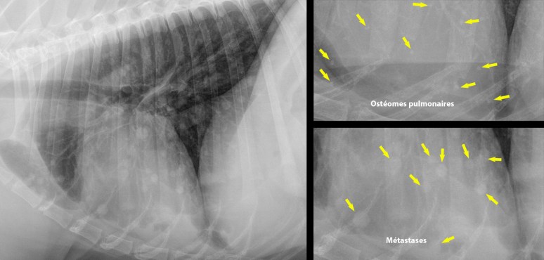 Laterale-mets-annotations