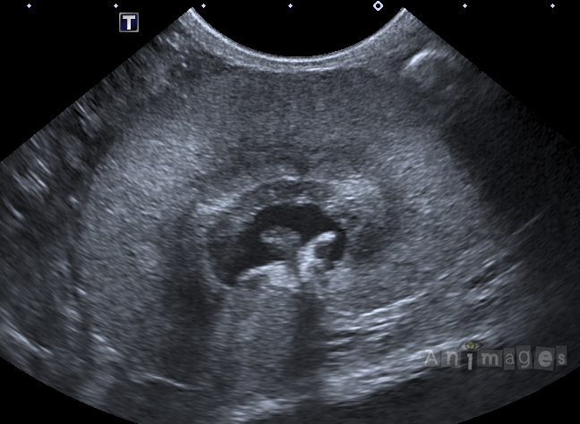 Histoire de rein final