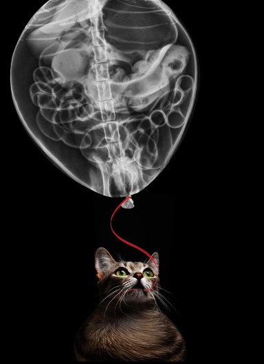 Pneumoperitoine en ballon