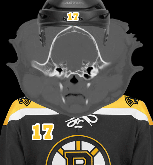 CT-Lucic