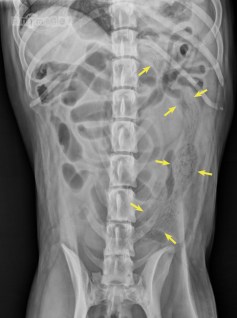 Yeurk mon bas Kira_VD