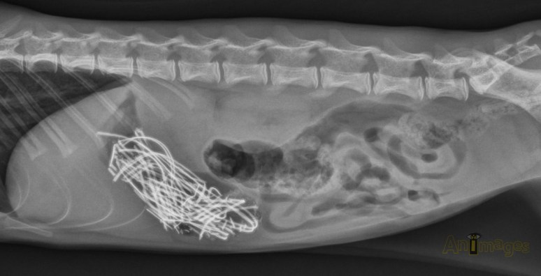 ingestion fils ecouteurs